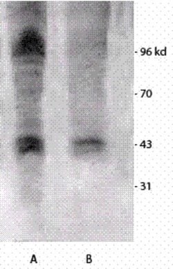 Phosphothreonine Antibody, Novus Biologicals 100 &mu;L; Unconjugated:Antibodies,